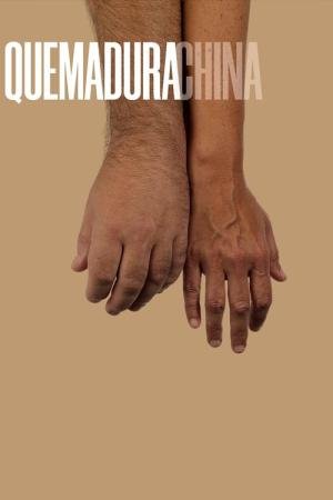 Queimadura chinesa (2025)